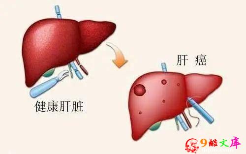 “解毒高手”公布，不是菊花，每天喝一点，排肝毒，增强肝动力